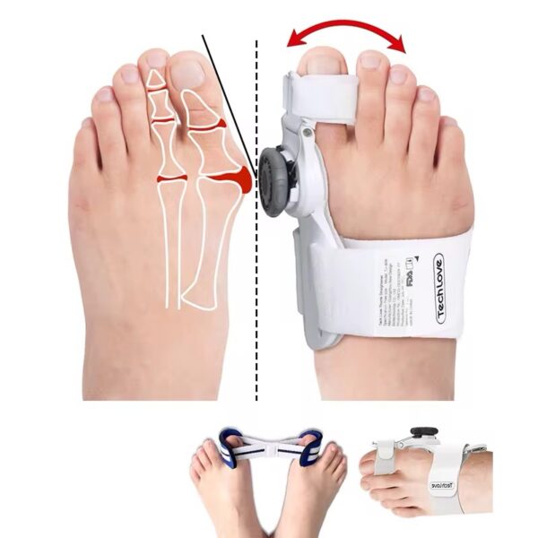 Помагало за Корекција на Палец на Стапала
